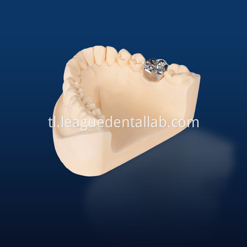 Full Gold crown,Full metal crown Non-precious, Full Metal crown Non-precious Yellow